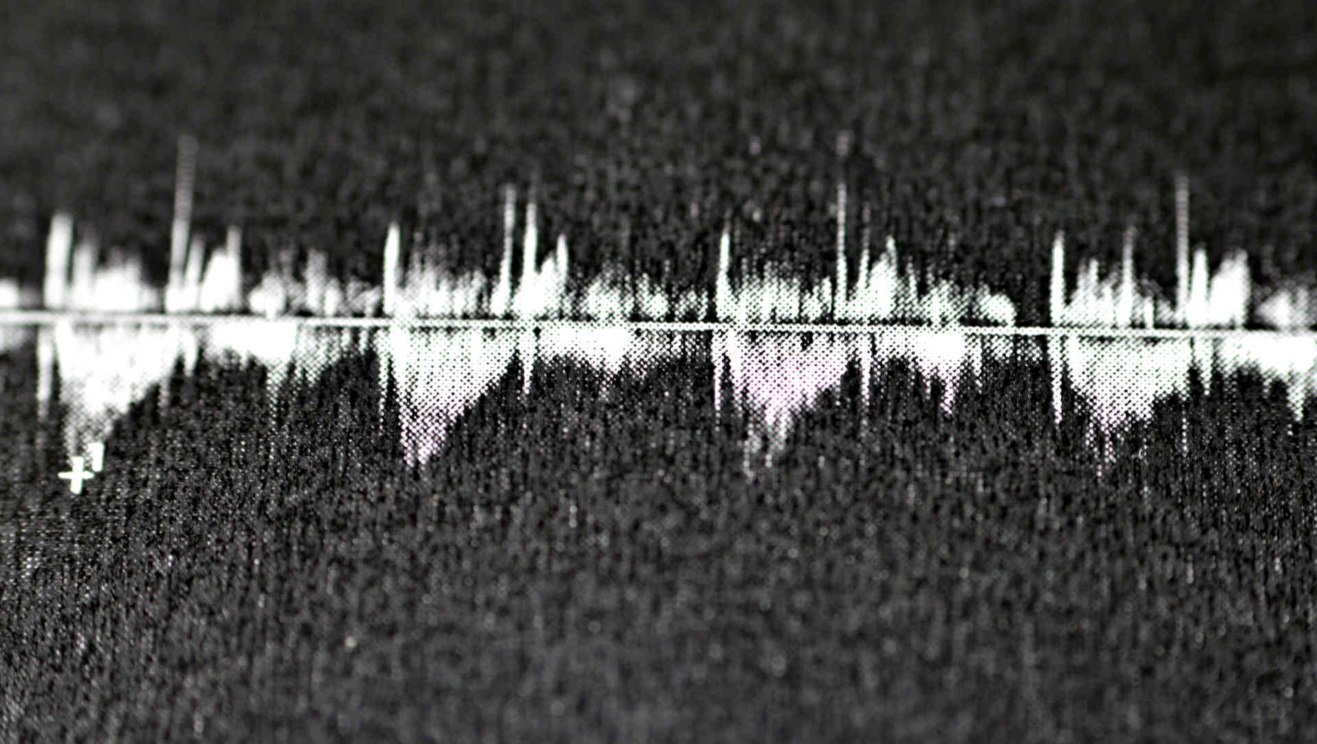 Cardiac doppler trace