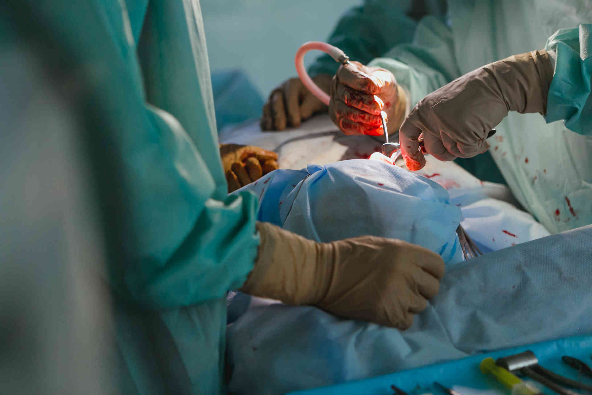 Surgeons performing a laparotomy