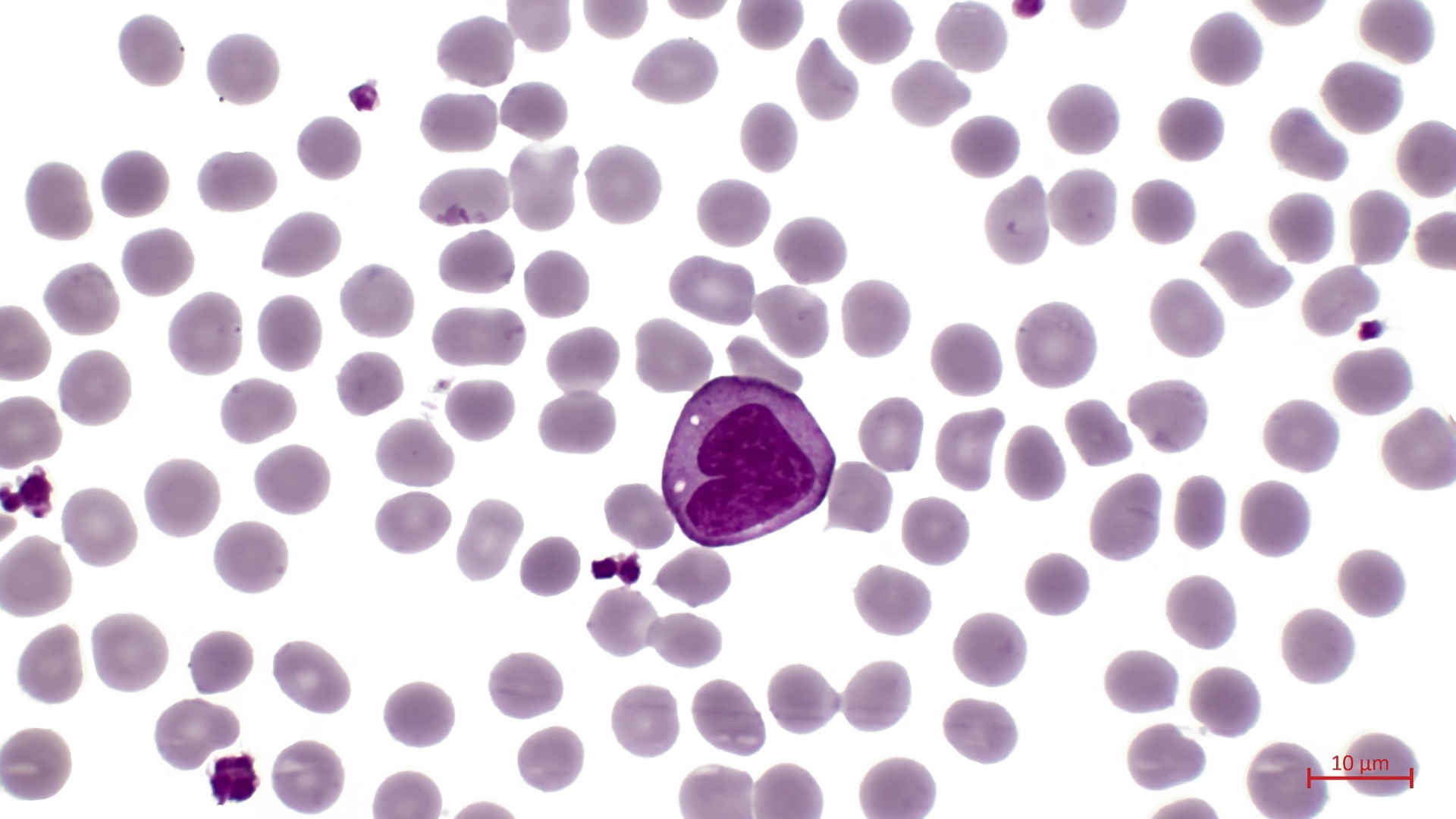 Monocyte in a blood film