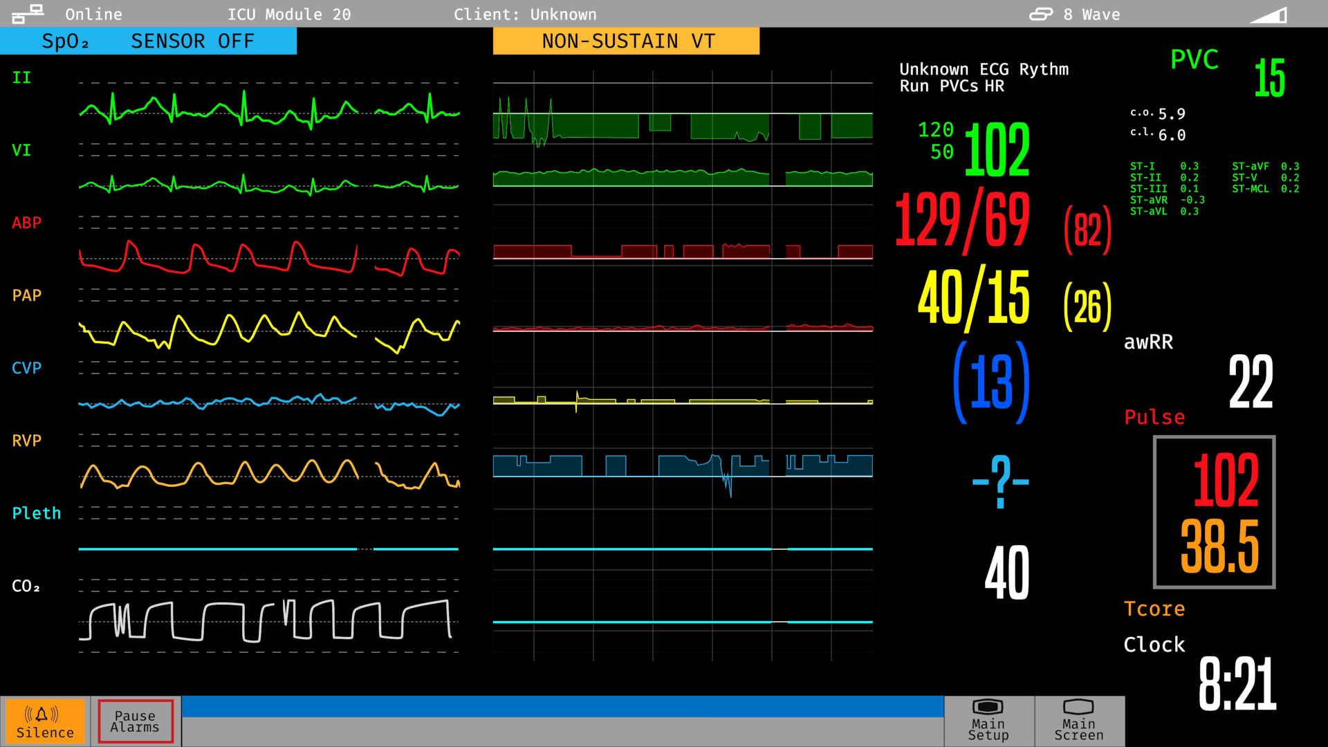 ICU bedside monitor screen