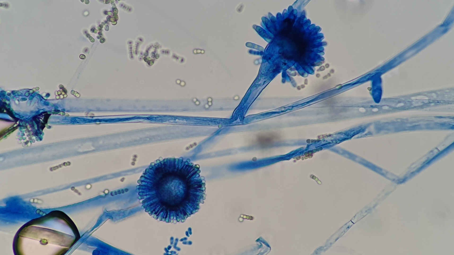 Microscopy showing aspergillus species